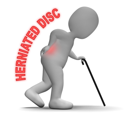 herniated - disc